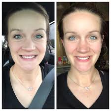 Looks even better daytime 🔥🔥☀️