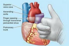 Image result for Pericardium