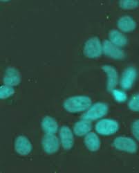 Cells are surrounded by a structure known as cell membrane. 133 Questions With Answers In Lysosome Science Topic