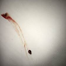 Welcome to the redwood creek inn in beautiful redwood city, california. 415 Jarvis Street Bed Bugs