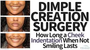 They can occur on different places of the body, including the cheeks, chin, and lower back. Dimple Creation Surgery How Long Cheek Indentation When Not Smiling Lasts Youtube