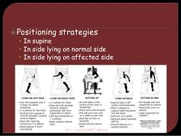 find out why is bed positioning is crucial for stroke patients