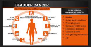 Matthew kincade with mercy clinic urology breaks down the signs of infection versus cancer: Bladder Cancer Causes Symptoms And Treatments