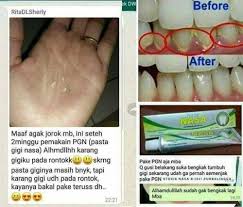 Obat Karang Gigi Pembersih Sekaligus Perontok Karang Gigi Original Nasa Lazada Indonesia