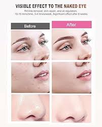 BETNEP Red Light Therapy Mask for Face,3 Modes Led Contour Face  Mask,Near-Infrared 850 Led Light Mask(NIR),Portable,Rechargeable and Remote  : Buy Online at Best Price in KSA