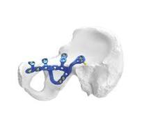 Anatomical Pelvic Acetabular Locking Plate,Medical Device ...