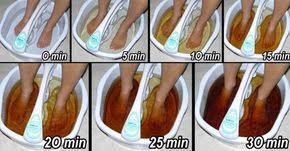 Using a bath of warm water and a handful of epsom salts to soak your feet will improve your healing blisters. To Detox Through Your Feet You Ll Need Epsom Salts Bentonite Clay Apple Cider Vinegar Hot Almost Boiling Water A Foot Detox Foot Detox Bath Foot Detox Soak