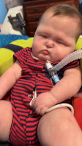 Ruby Whitaker Disability