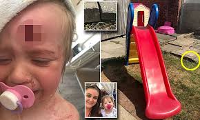 Two-year-old girl left with hole in head after plastic slide topples onto  uneven concrete paving