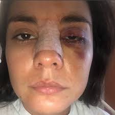 Ella es @eileenmorenoact una actriz y persona maravillosa. Fue golpeada por  su ex novio @alejandrogarciaactor hace más de dos meses y nada ha pasado.  ¡Es que no puede ser! ¿Hasta cuando? Eileen,