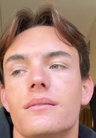 Mason Davis Car Accident