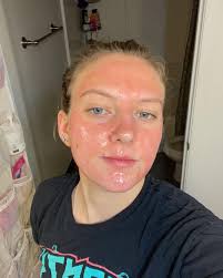 The horse is eating my foot