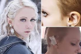 Successful scarification takes a lot of efforts from both the artist and the wearer. 20 Strange Body Modifications That People Actually Have