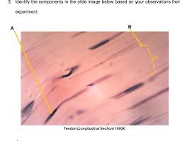 Slide 106 and 112 have bits of well preserved flexor tendon at the top of the section (the tissue at the very top of slide 112 is Label A And B In Each Diagram A Sketch Chegg Com