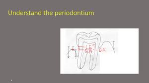 6 Point Pocket Chart And Related Perio Terms A Nightmare Not Anymore