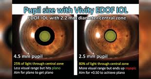 Image result for Pupil