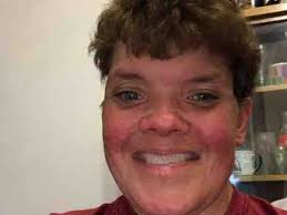 Fundraiser by Zachary Boyd : A Little Help For A Little Peg