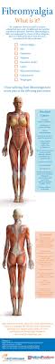 Pin On Fibromyalgia