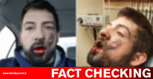 Vietato fumare in luogo pubblico per proteggere l'ambiente e tutelare la propria salute e di chi sta intorno. Il Caso Di Andrew Hall E La Sigaretta Elettronica Esplosa Il Blog Di David Puente