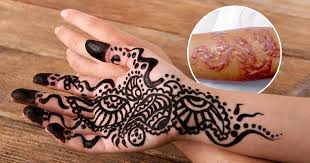Dry and damaged hair is very. Ash Kumar Explains How To Tell If Someone S Using Illegal Black Henna Metro News