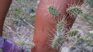 I can't go to the doctor because i can't explain to my mom how they got there. Sneaky Jumping Cholla Cactus Attack Youtube