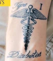 There are two main forms of acp documents: When A Tattoo Says Do Not Resuscitate Pressreader