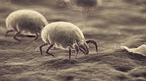 Image result for Dust mite