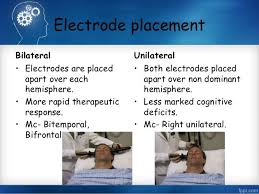 Electro Convulsive Therapy Psychiatric Nursing Therapy Therapeutic