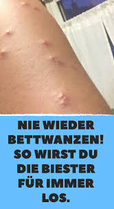 Meine schwester singt gern, deshalb besucht sie konzerte gern. So Wirst Du Bettwanzen Endgultig Los Ohne Viel Chemie Bettwanzen Ich Bin Immer Fur Dich Da Wanze