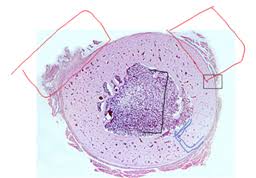 This is a high power photo of a single haversian system. Histology Lab Practical 2 Flashcards Quizlet