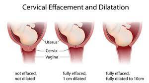 تمدد عنق الرحم أثناء المخاض والولادة - فيرست كراي العربية للأبوة والأمومة  تمدد عنق الرحم أثناء المخاض والولادة