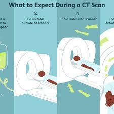 Ct Scan Uses Side Effects Procedure Results