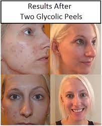 Pin On Beauty And Skincare