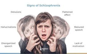 Image result for Schizozygia