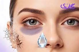‫بهترین کرم دور چشم برای رفع سیاهی و گودی | 5 محصول + قیمت‬‎