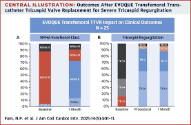 Transfemoral Transcatheter Tricuspid Valve Replacement With The Evoque System A Multicenter Observational First In Human Experience Sciencedirect