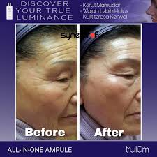 Kontak +628112338376 jual trulum review obat flek hitam membandel di area gintangan, rogojampi, banyuwangi trulum adalah produk skincare 100. Jual Trulum Di Cirebon 0811 233 8376