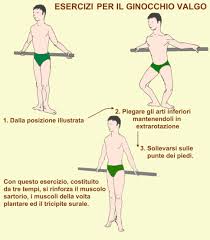 I paramorfismi e i dismorfismi