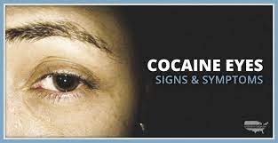 That's guesswork—it's quite uncertain and variable—but the guess is that it takes about 1.5 grams at one time, taken orally, and less, by injection, in order to kill someone. Cocaine Eyes Signs Symptoms Vertava Health