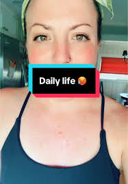 Understanding End Stage Heart Failure and Daily Life