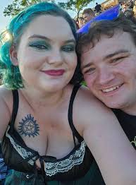 I'm new to this group. Heres me in my teens vs now