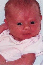 Births: Reinbold birth (9/2/08)