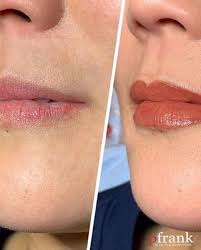 The permanent lip blush compliments your natural lip color. What Is Lip Blushing Permanent Lip Blush Tattoo Before After