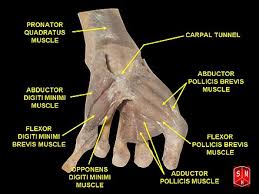 It lies lateral to the abductor digiti minimi when the hand is in anatomical position. Flexor Digiti Minimi Brevis Muscle Hand