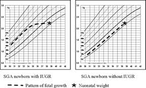 Intrauterine Growth Restriction Neonatal Aspects Springerlink