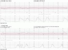 Exercises In Electronic Fetal Monitoring Obgyn Key