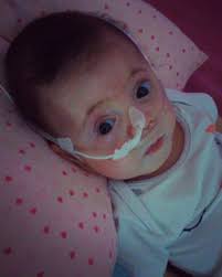 bebe de oito meses precisa de ajuda para realizacao de cirurgia no valor de r 15 mil portal arauto