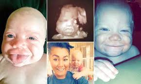 Baby who could have choked