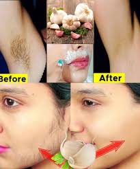 Stop shaving! Here's how to permanently get rid of facial, body and pubic  hair!...