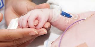 Image result for Difficult Intravenous Access in Children